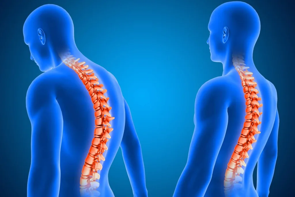 Bel Ağrısına Neden Olan Faktörler Nelerdir?